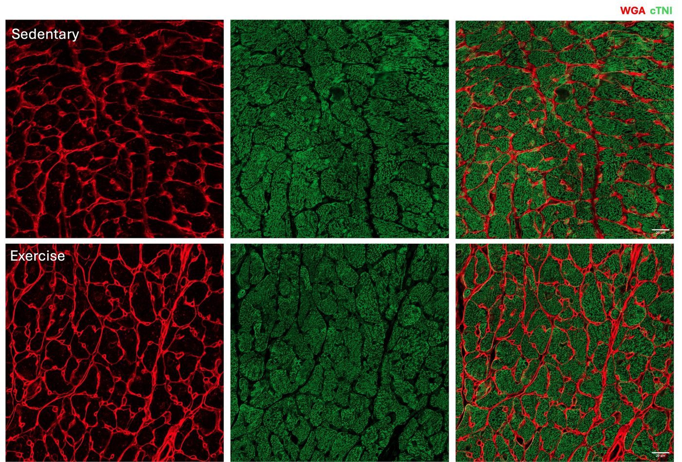 Immunofluorescence imaging of exercised hearts